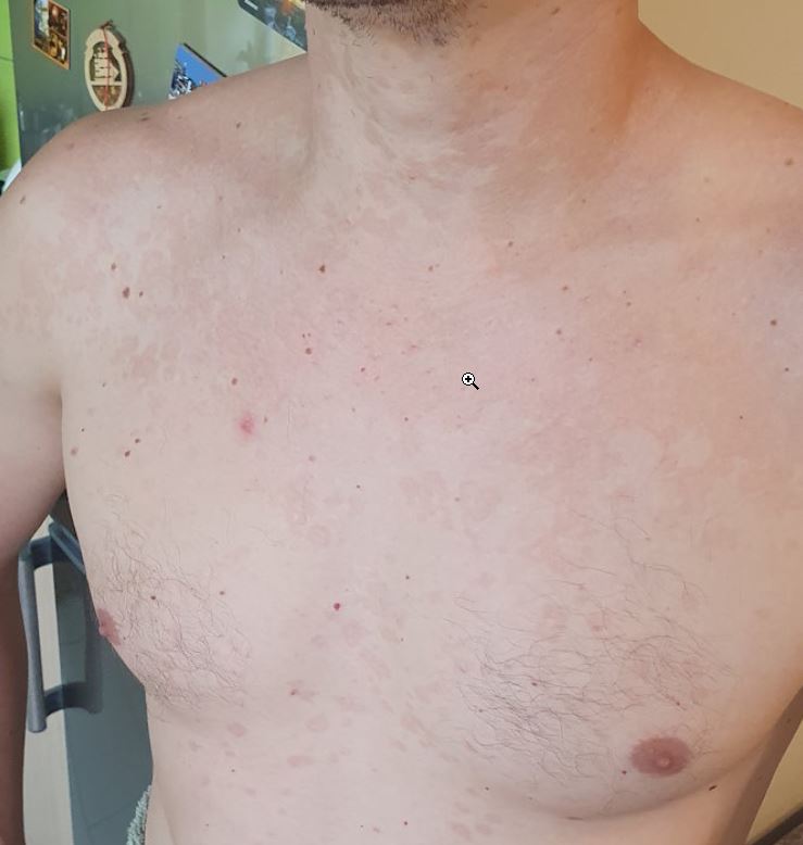 Kā es nepareizi mēģināju salabot savu vēderu un ko no tā iemācījos